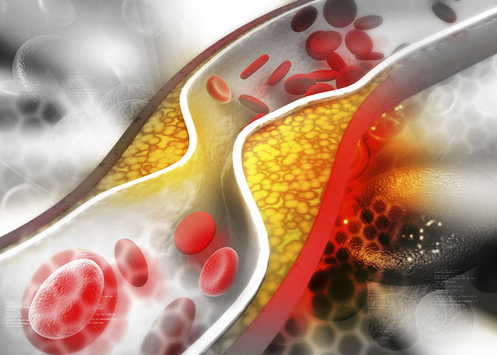 colosterolo-700×500
